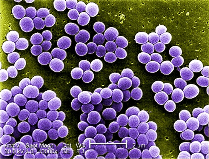 Pus forming bacteria that grow in clusters