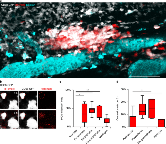 Follows irregular contours of spinal cord surface